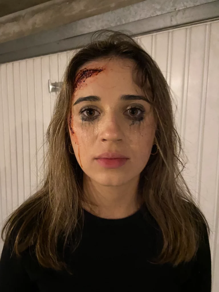 Une femme au maquillage estompé et aux blessures faciales simulées se tient debout devant un fond clair.