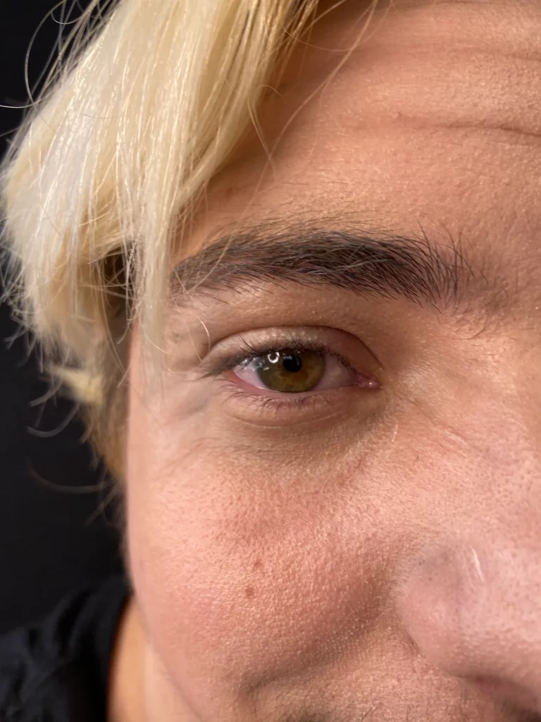 Gros plan sur le côté gauche du visage d'une personne, mettant l'accent sur un œil et des fausses rides.