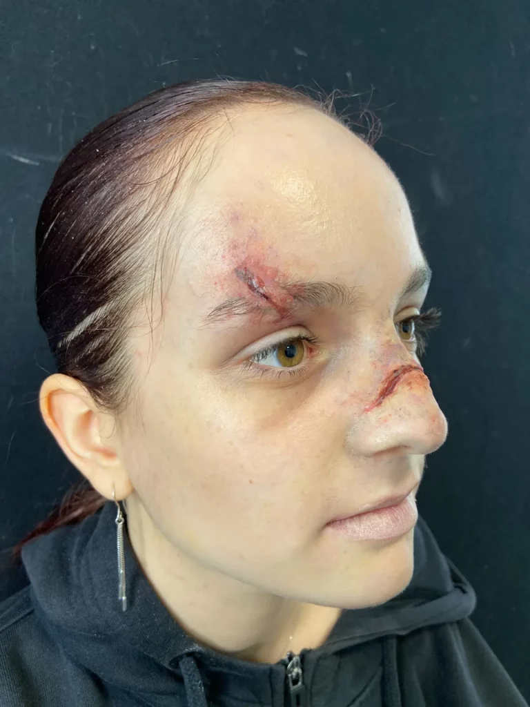 Focus sur le visage d'une modèle avec de fausses plaies à l'arcade et au nez