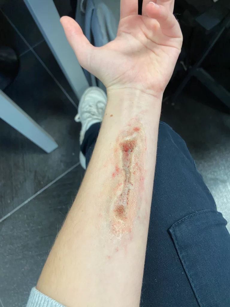 Photo d'un bras avec un gros plan sur une prothèse de fausse plaie maquillée