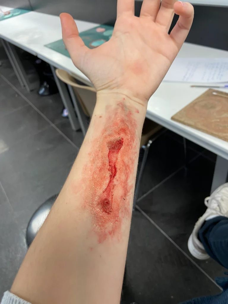 Gros plaie sur une prothèse de plaie sur un bras maquillée avec du faux sang